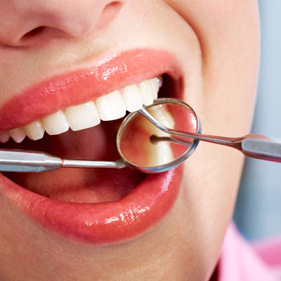 Эстетическая рестврация зубов